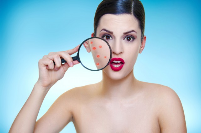 脸上痘痘痤疮怎么调理,这样做能有效缓解