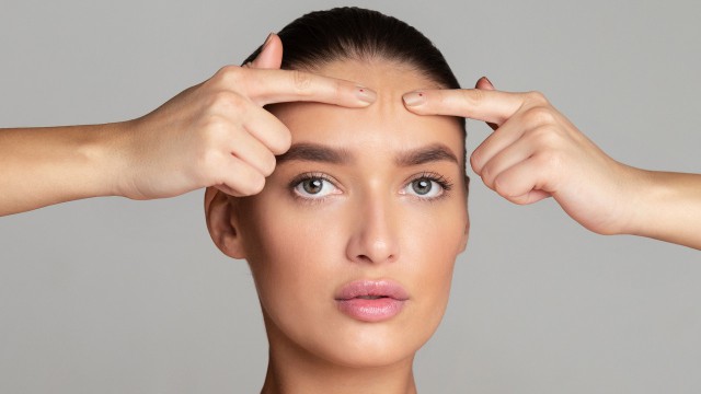 去痘痘的日常方法,教你简单祛痘小妙招