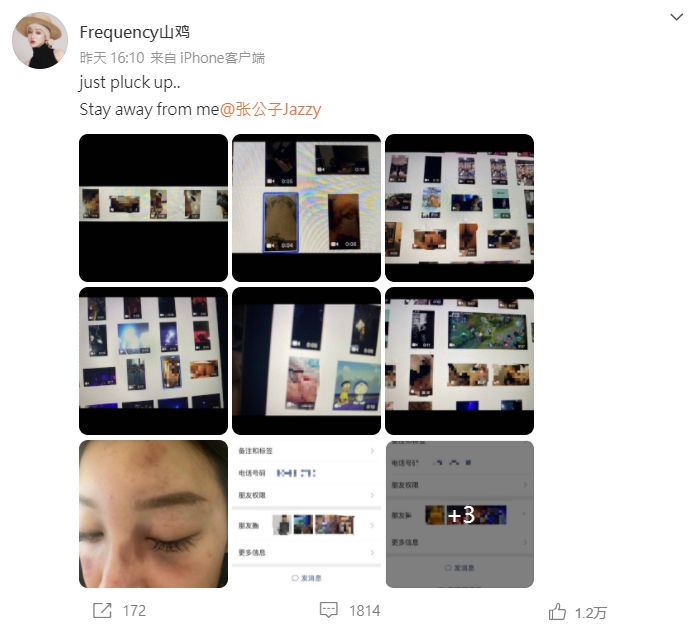 Frequency山鸡前男友家暴还约P 黑料一堆曝光