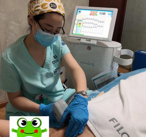 「真人测评」miradry清新微波止汗祛腋臭60天，运动后腋下超干爽！