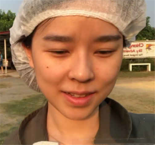 网红素颜出镜,贝勒爷爆痘,大美脸上有斑,看到韩安冉:没白整