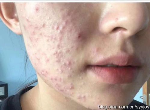 再多的“海蓝之谜”,也敌不过一条“臭毛巾”