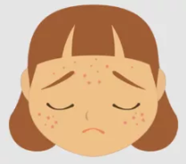 祛痘痘、痘印，平痘坑：UP雷射＋超光子，痘肌油皮的福音！