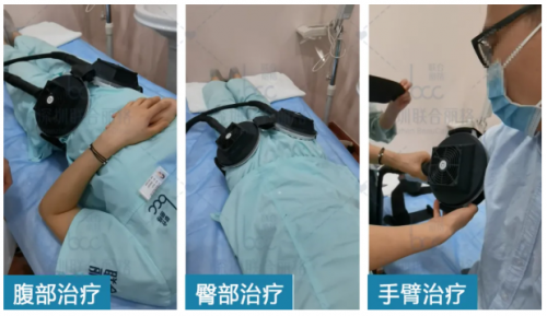 有了fotona星丽人“全能增肌王”，马甲线、蜜桃臀、小鸟腿都不是事！