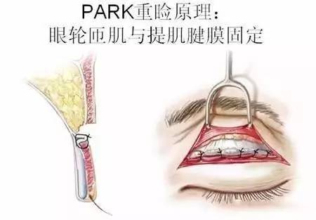 为什么孙峰医生的手术还需要排队预约?