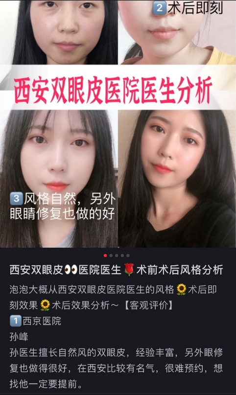 为什么孙峰医生的手术还需要排队预约?