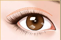 为什么孙峰医生的手术还需要排队预约?