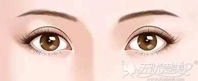 为什么孙峰医生的手术还需要排队预约?