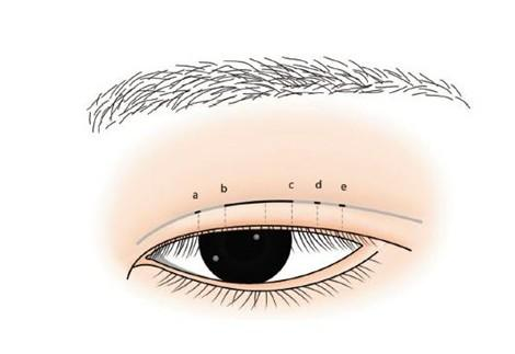 为什么孙峰医生的手术还需要排队预约?