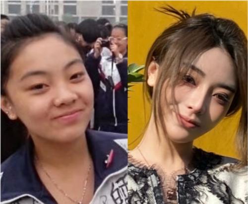网红温精灵承认整容,前后对比图明显,粉丝:就是喜欢她的直率