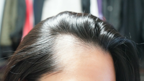 脱发严重，就用Dr.FORHAIR洗发水增发密发富含高浓缩的营养物质