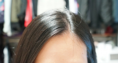 脱发严重，就用Dr.FORHAIR洗发水增发密发富含高浓缩的营养物质