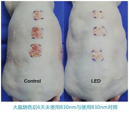 能修复痘肌、敏感肌,号称“胶原光”的嗨光来啦!