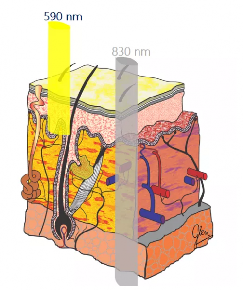 能修复痘肌、敏感肌,号称“胶原光”的嗨光来啦!