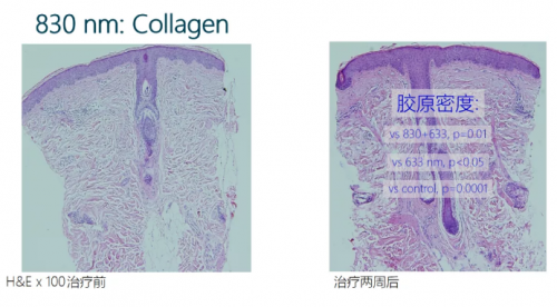 能修复痘肌、敏感肌,号称“胶原光”的嗨光来啦!