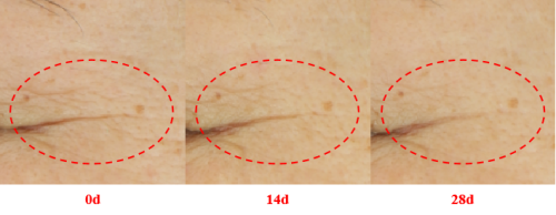 国人亲测！Amilera安瓶淡纹美白效果双验证