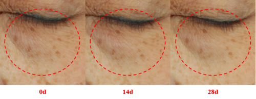 国人亲测！Amilera安瓶淡纹美白效果双验证