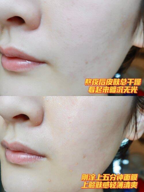 熬夜怎么补救,雪肌精黄金睡眠面膜“自觉”重整受损干糙肌