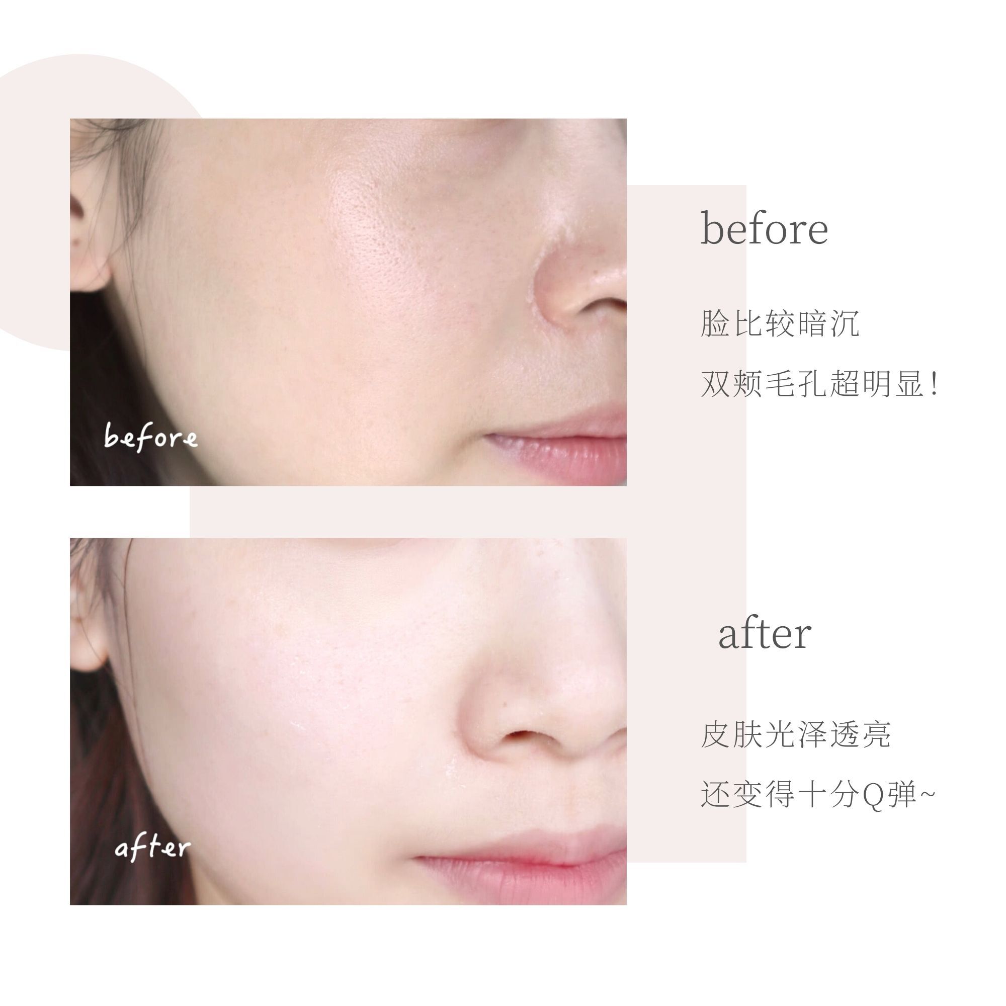 私藏护肤好物分享 | 德国MBK多效小白瓶