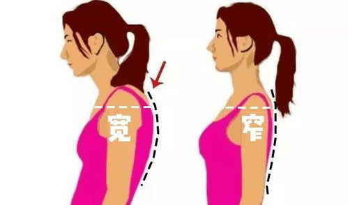 脖子前倾的正确睡姿图 该怎么纠正呢？