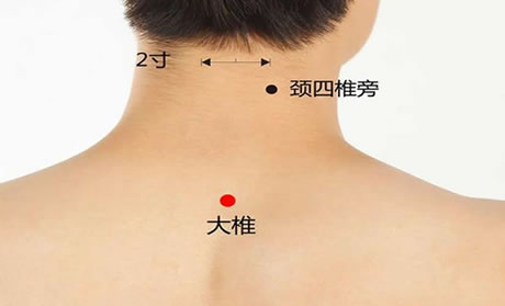 三伏贴贴敷部位图 这7个位置最佳(图解) 三伏贴贴敷部位图 这7个位置最佳(图解)