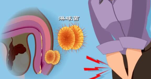 男性怎么判断自己得性疾病了-1 男性怎么判断自己得性疾病了