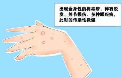 男性怎么判断自己得性疾病了-4 男性怎么判断自己得性疾病了