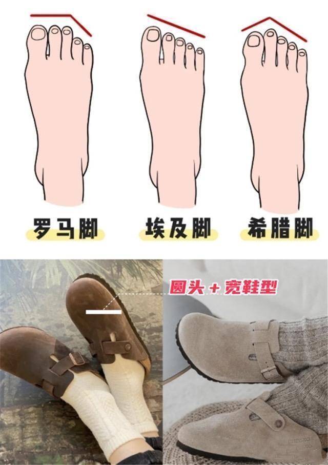 今年德训鞋和勃肯鞋搭配阔腿裤，松弛高级还显气质