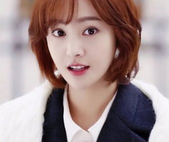 戚薇下巴动刀上百次照样美,为何郑爽整了一次就成了开瓶器