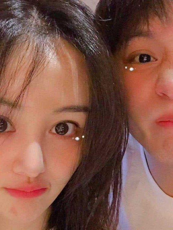 郑爽晒自拍掩盖嘴角伤疤，还意外暴露男友对她“爱的呼唤”