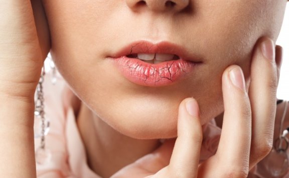 嘴皮干燥起皮怎么办，教你护唇小妙招
