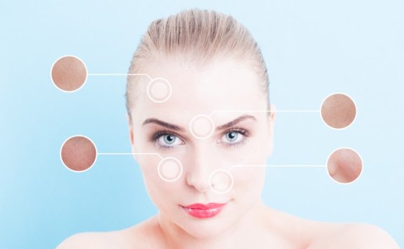 面部毛孔粗大有黑头怎么办 毛孔粗大有黑头改善小妙招