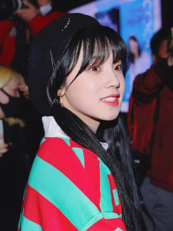 宋雨琦扎双马尾穿撞色条纹衫戴贝雷帽，清甜娇嫩似小学妹