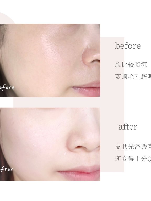 私藏护肤好物分享 | 德国MBK多效小白瓶