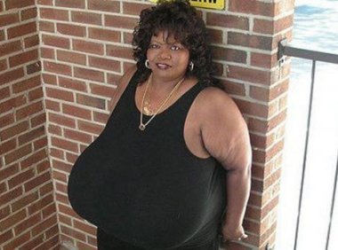 世界上最大胸重排行,安妮·霍金斯特纳胸部重达77斤