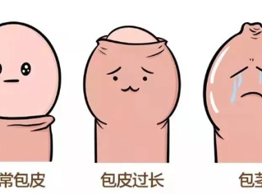 到底啥样的包皮需要割？出现这几种情况时…