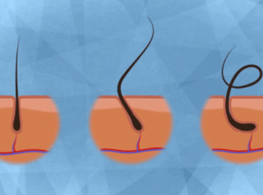 私处毛毛能刮吗？顺着刮还是逆着刮